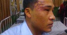 NE student roughed up in Delhi