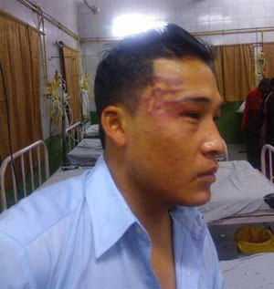 NE student roughed up in Delhi