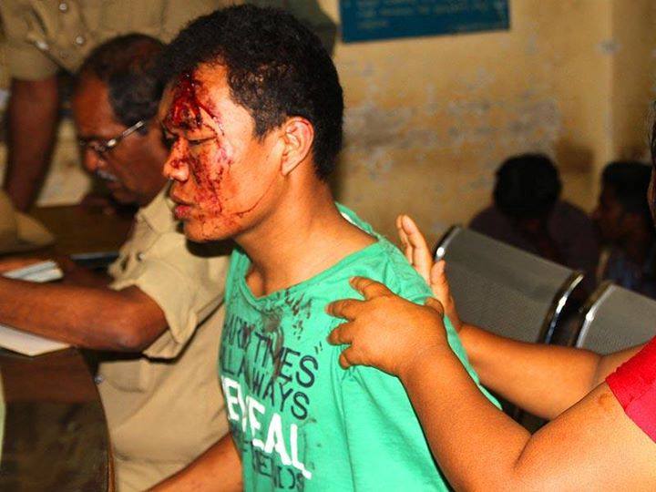 Manipur student attacked in B’lore