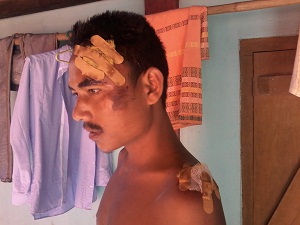 Two injured on mishap in Kokrajhar