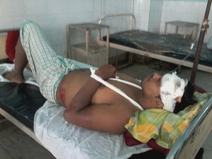 Road mishap