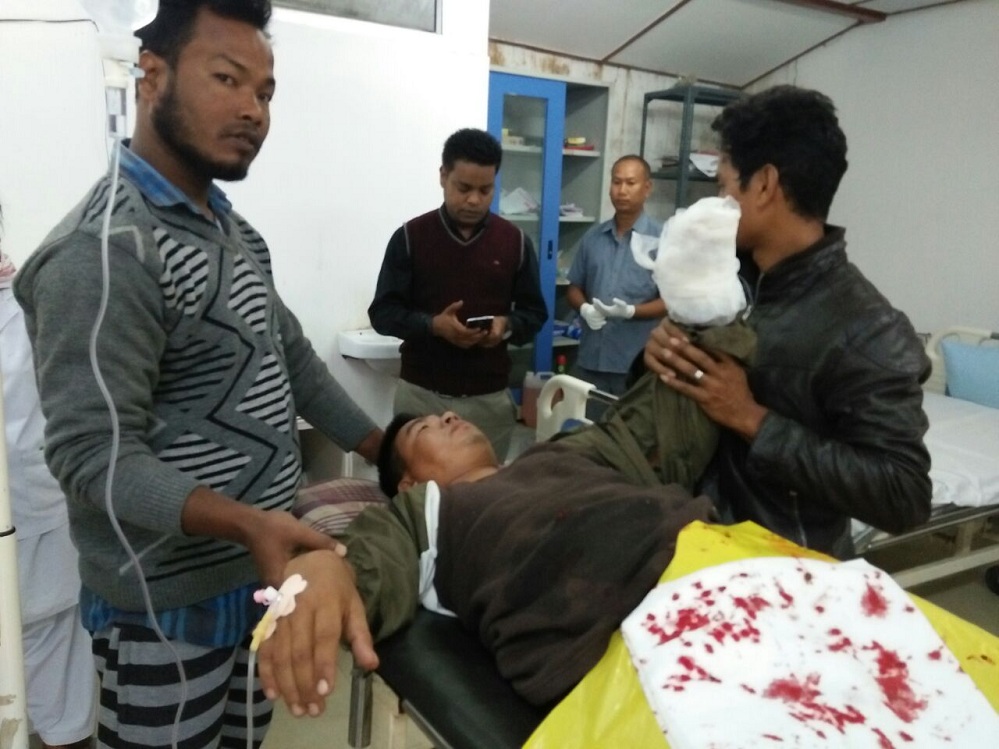 One hurt in firing in Kokrajhar