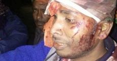 10 hurt in Tripura campaign clash