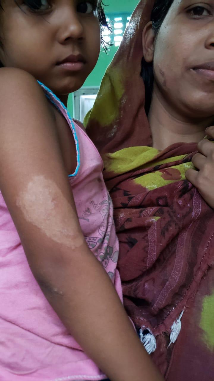 Epedemic skin disease attacks Mahendraganj area of Garo Hills