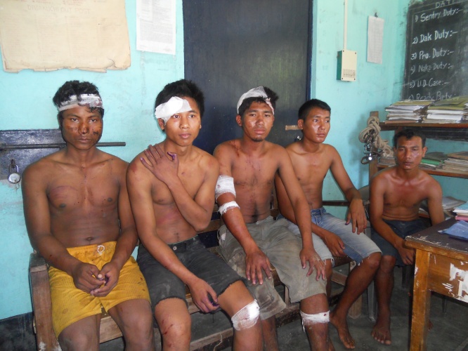 5 NDFB (AT) beaten by irate villagers in Udalguri