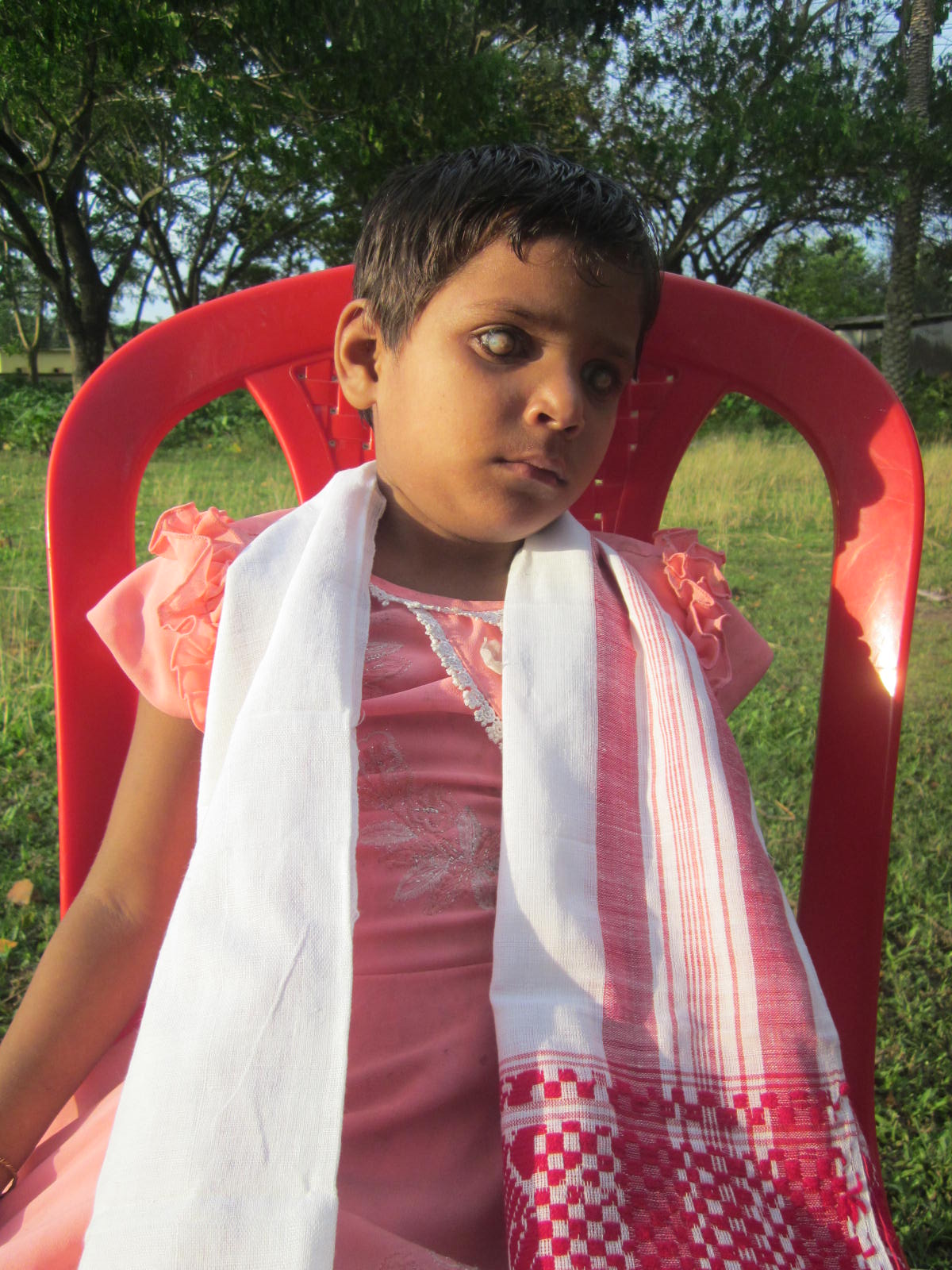 5 years old blind orphan Priyanka to get a new life