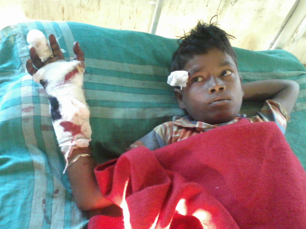 Injured child labour critical 